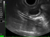 l'image diagnostique des ovaires de la vache, l'examen rectal de la vache