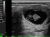 38 día del preñez en vaca – examen con la sonda rectal lineal 